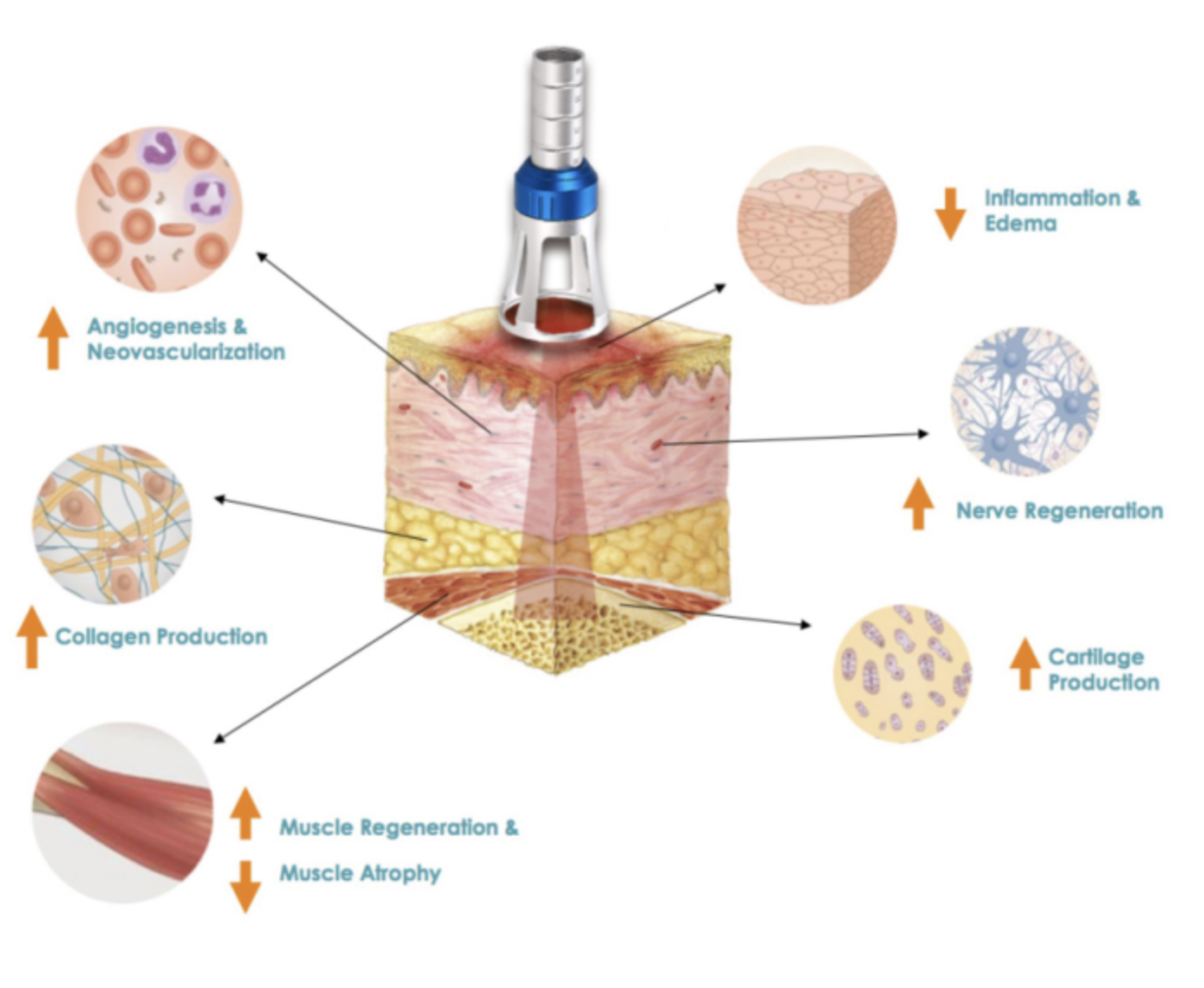 Class 4 Laser Therapy effects on the body — nerve regeneration, collagen production, inflammation reduction, muscle regeneration