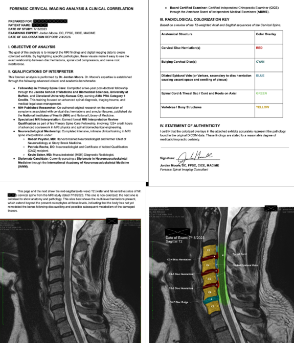 Forensic Cervical Imaging Analysis and Clinical Correlation report by Dr. Jordan Moore — colorized MRI with radiological key