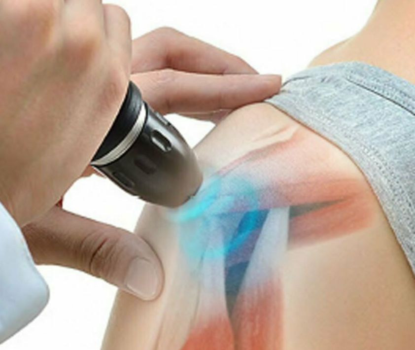 Shockwave therapy treatment — Duolith SD1 Ultra at Optimum Chiropractic Care Mobile AL